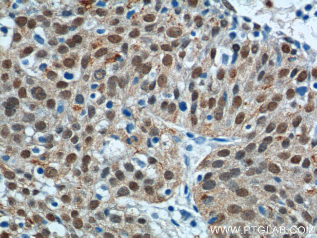 SOX2 Antibody in Immunohistochemistry (Paraffin) (IHC (P))