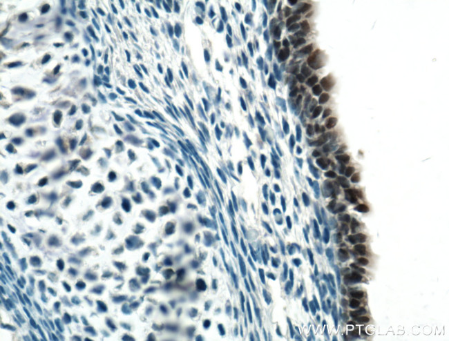 SOX2 Antibody in Immunohistochemistry (Paraffin) (IHC (P))