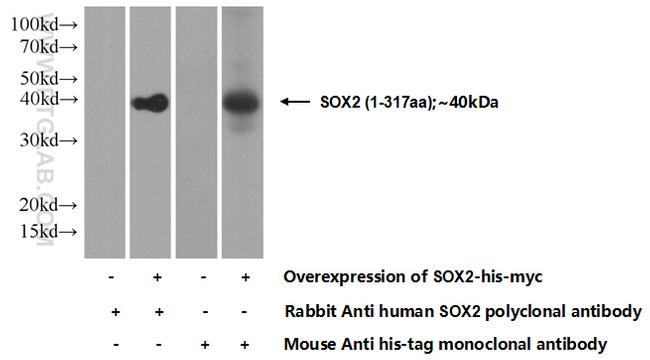 SOX2 Antibody in Western Blot (WB)