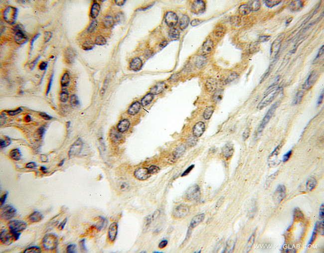 IGFBP2 Antibody in Immunohistochemistry (Paraffin) (IHC (P))