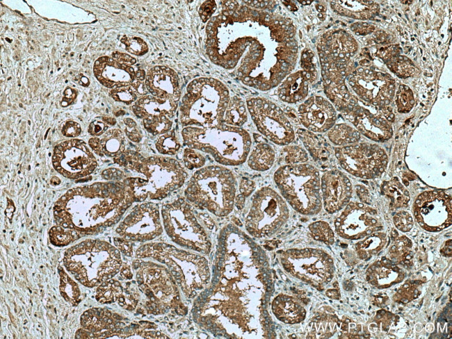 IGFBP2 Antibody in Immunohistochemistry (Paraffin) (IHC (P))