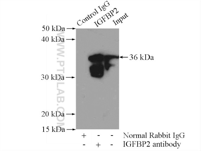 IGFBP2 Antibody in Immunoprecipitation (IP)