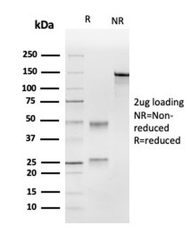 Ubiquitin-conjugating Enzyme E2C/UBCH10 Antibody in SDS-PAGE (SDS-PAGE)