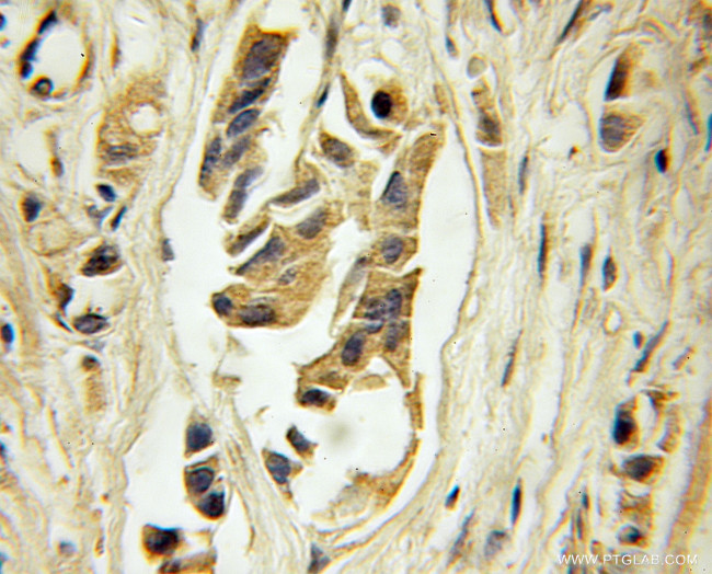 CA9 Antibody in Immunohistochemistry (Paraffin) (IHC (P))