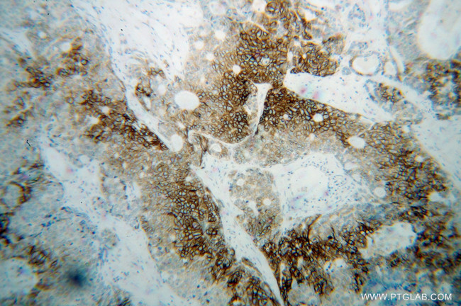 CA9 Antibody in Immunohistochemistry (Paraffin) (IHC (P))