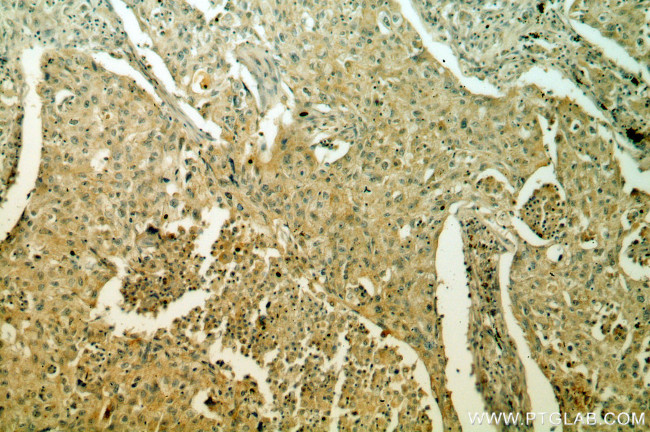 CA9 Antibody in Immunohistochemistry (Paraffin) (IHC (P))