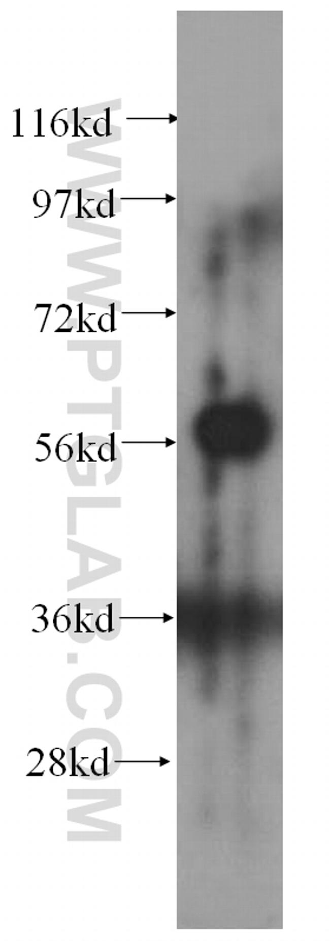 CA9 Antibody in Western Blot (WB)