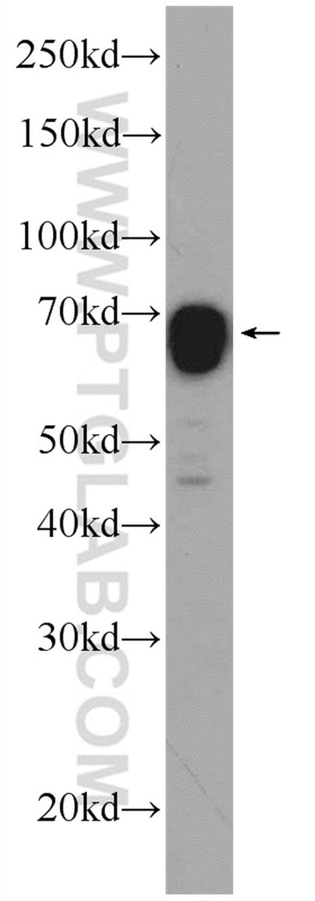 CA9 Antibody in Western Blot (WB)