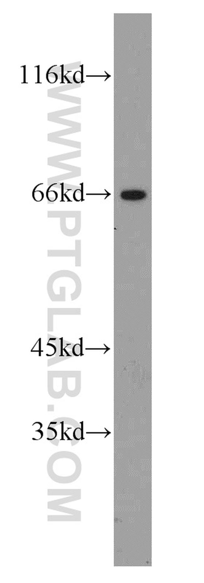 CA9 Antibody in Western Blot (WB)