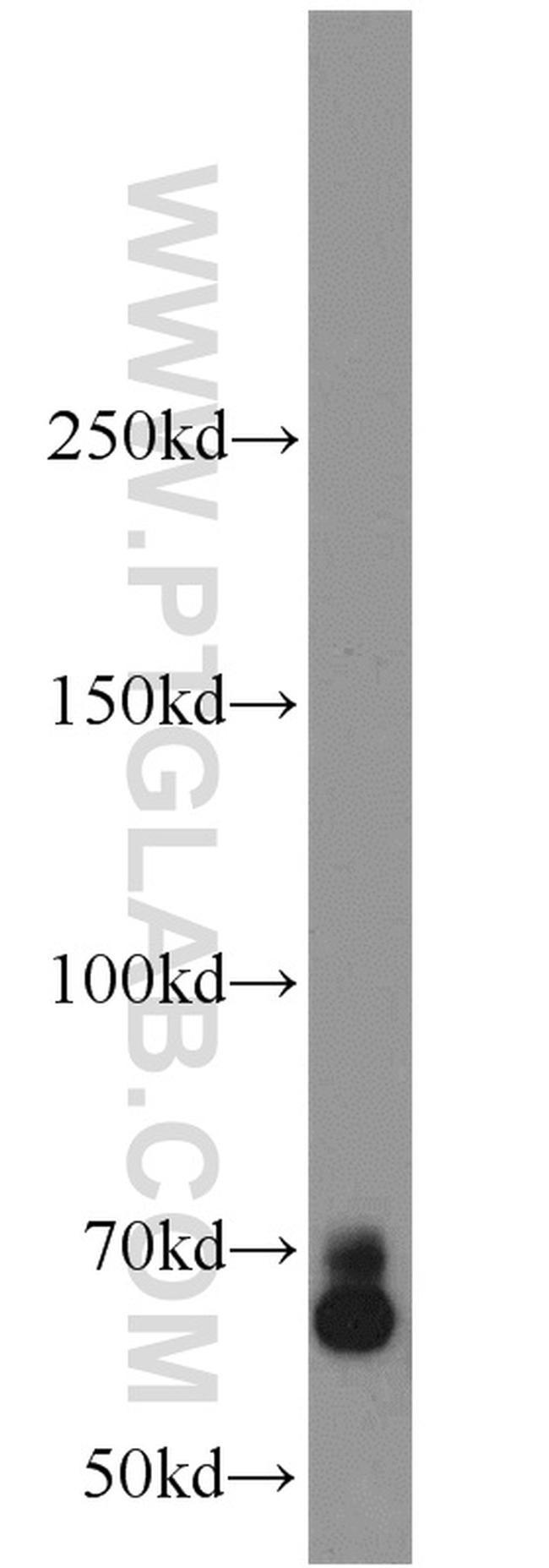 CA9 Antibody in Western Blot (WB)