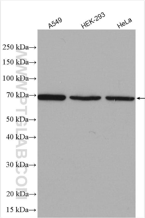 CA9 Antibody in Western Blot (WB)