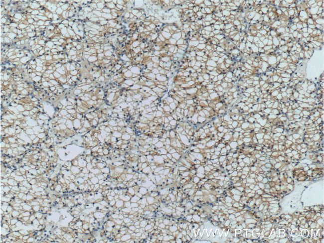 CA9 Antibody in Immunohistochemistry (Paraffin) (IHC (P))