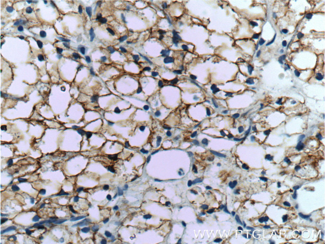 CA9 Antibody in Immunohistochemistry (Paraffin) (IHC (P))