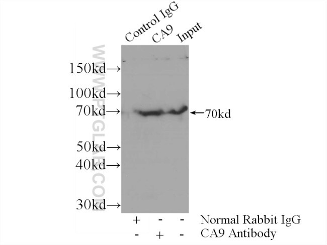 CA9 Antibody in Immunoprecipitation (IP)