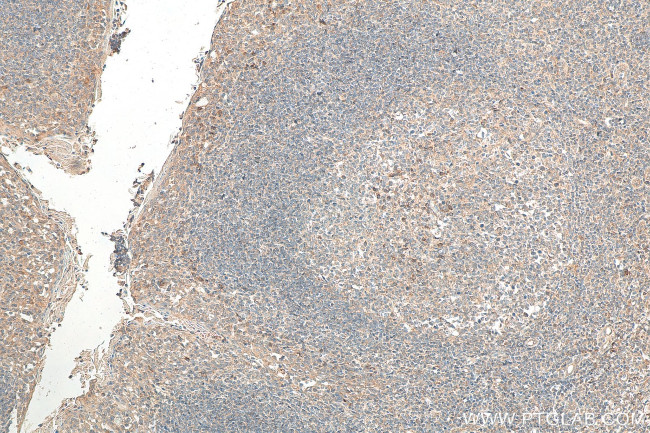 CXCR4 Antibody in Immunohistochemistry (Paraffin) (IHC (P))