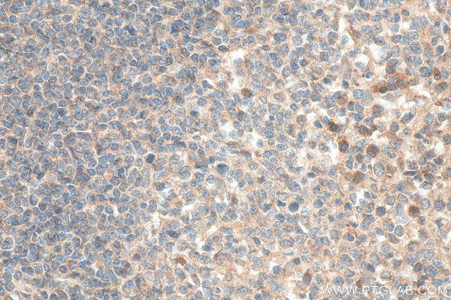 CXCR4 Antibody in Immunohistochemistry (Paraffin) (IHC (P))