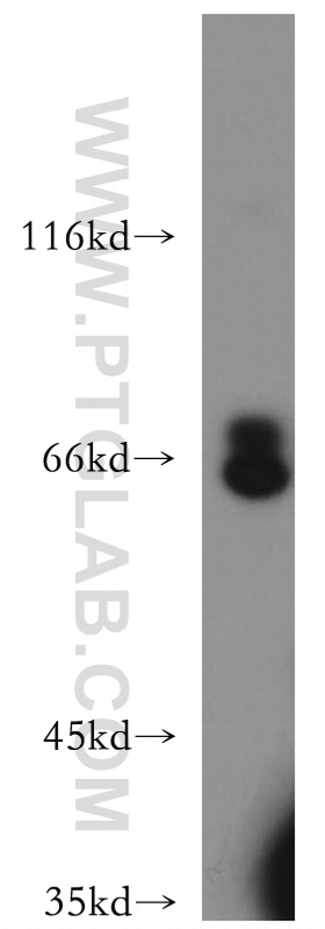 CXCR4 Antibody in Western Blot (WB)