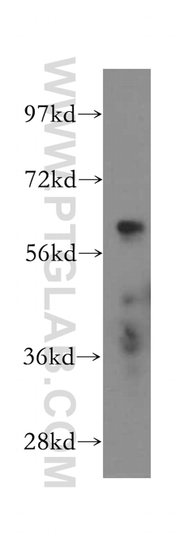 CXCR4 Antibody in Western Blot (WB)