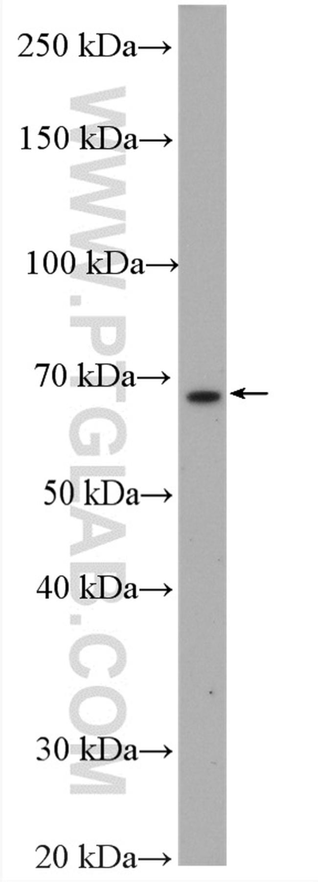 CXCR4 Antibody in Western Blot (WB)