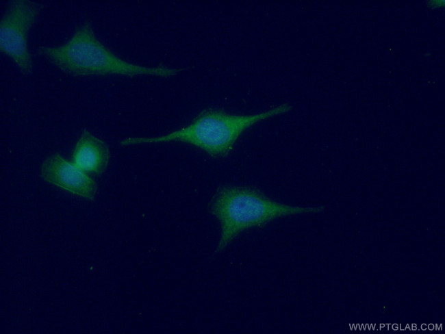 Oligophrenin 1 Antibody in Immunocytochemistry (ICC/IF)