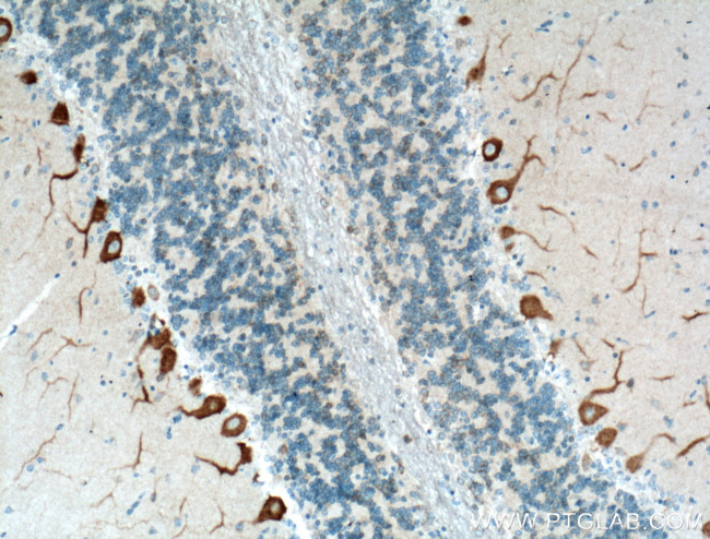 Oligophrenin 1 Antibody in Immunohistochemistry (Paraffin) (IHC (P))