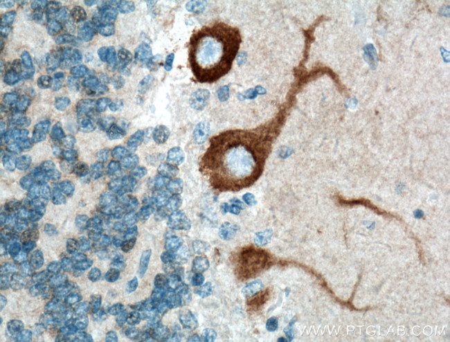 Oligophrenin 1 Antibody in Immunohistochemistry (Paraffin) (IHC (P))