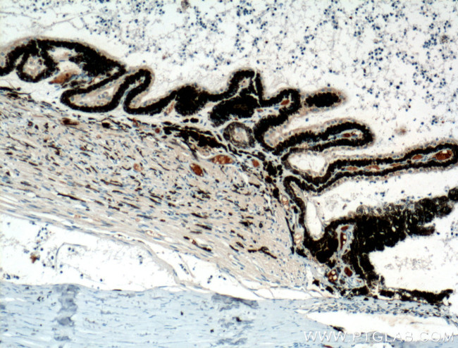 Oligophrenin 1 Antibody in Immunohistochemistry (Paraffin) (IHC (P))