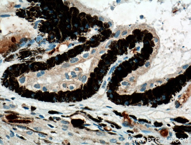 Oligophrenin 1 Antibody in Immunohistochemistry (Paraffin) (IHC (P))