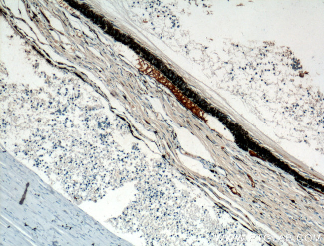 Oligophrenin 1 Antibody in Immunohistochemistry (Paraffin) (IHC (P))