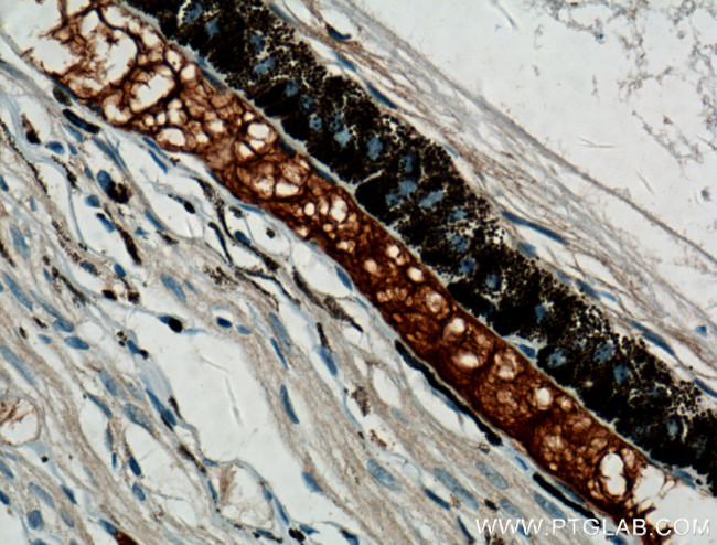 Oligophrenin 1 Antibody in Immunohistochemistry (Paraffin) (IHC (P))