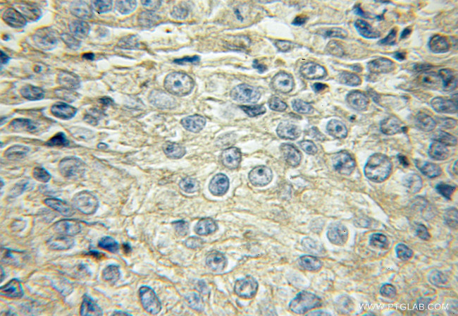 SLCO6A1 Antibody in Immunohistochemistry (Paraffin) (IHC (P))