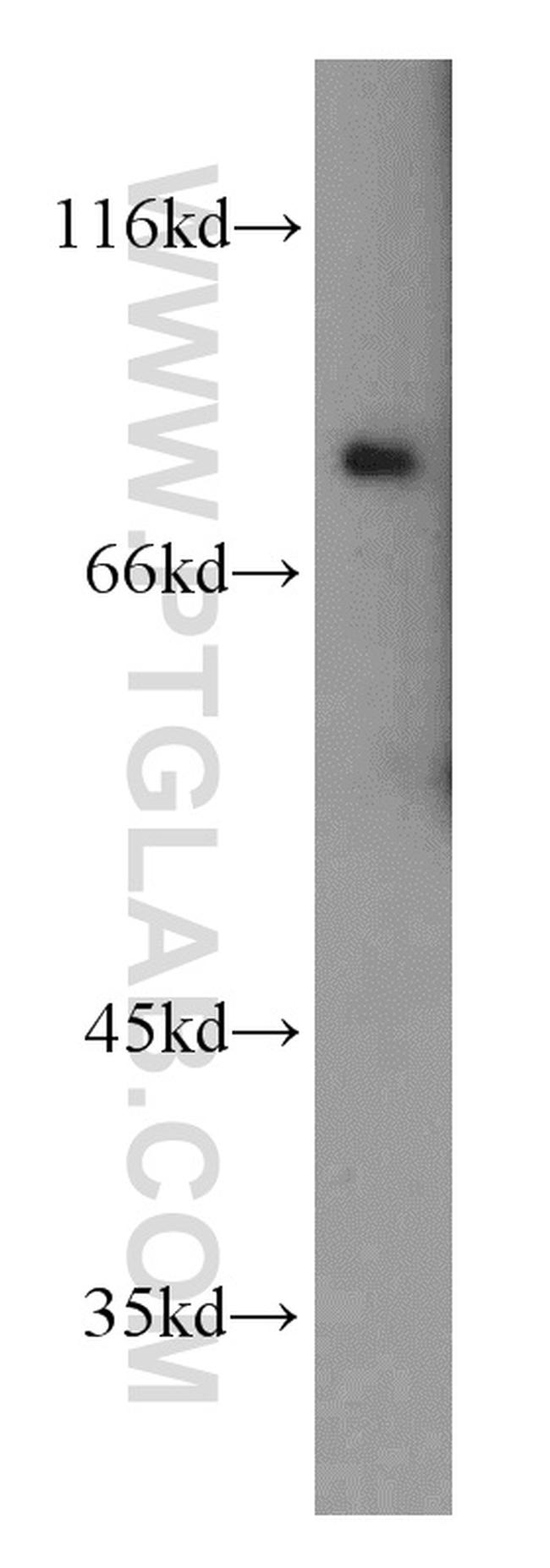 SLCO6A1 Antibody in Western Blot (WB)