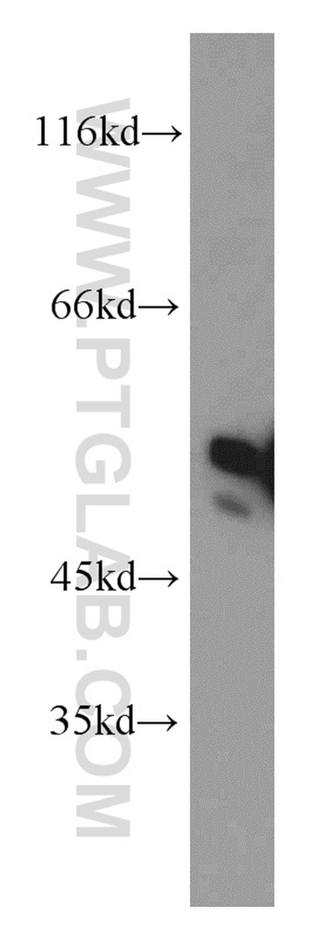 SLCO6A1 Antibody in Western Blot (WB)