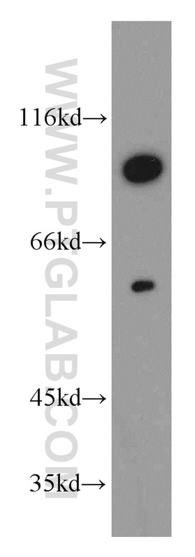 SLCO6A1 Antibody in Western Blot (WB)