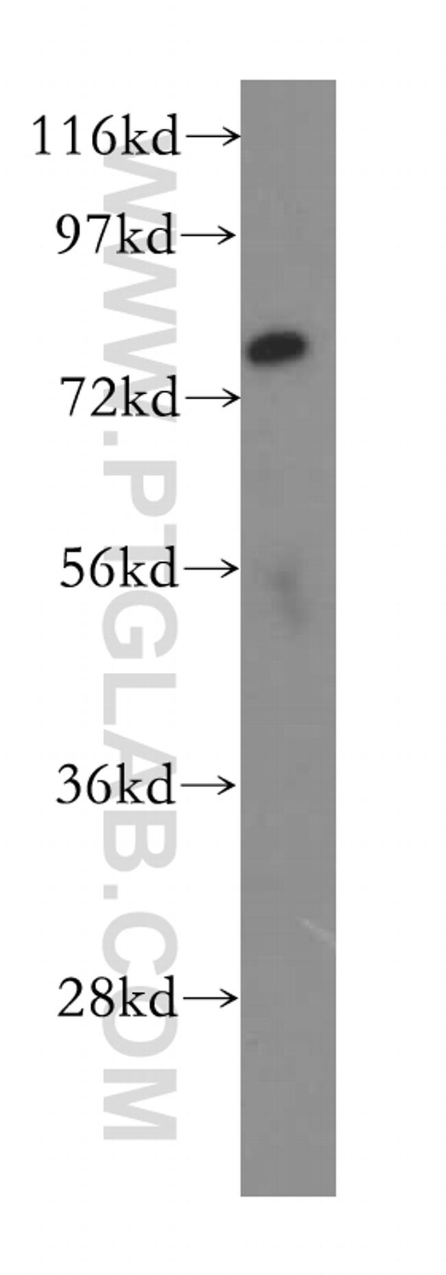 SLCO6A1 Antibody in Western Blot (WB)