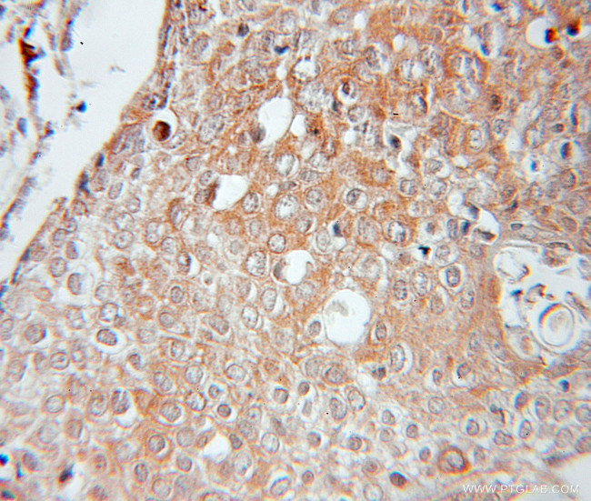 IL32 Antibody in Immunohistochemistry (Paraffin) (IHC (P))