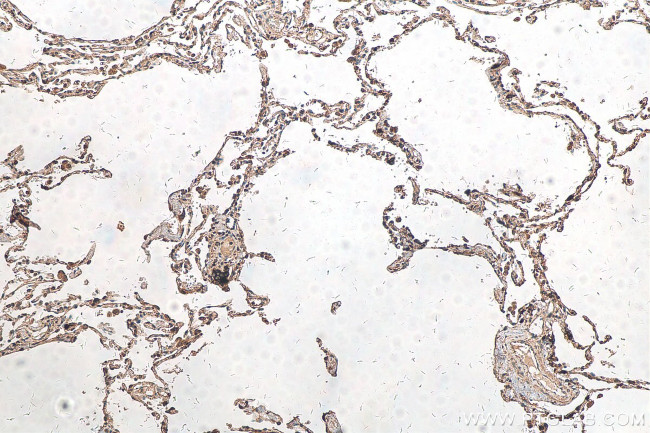 IL32 Antibody in Immunohistochemistry (Paraffin) (IHC (P))