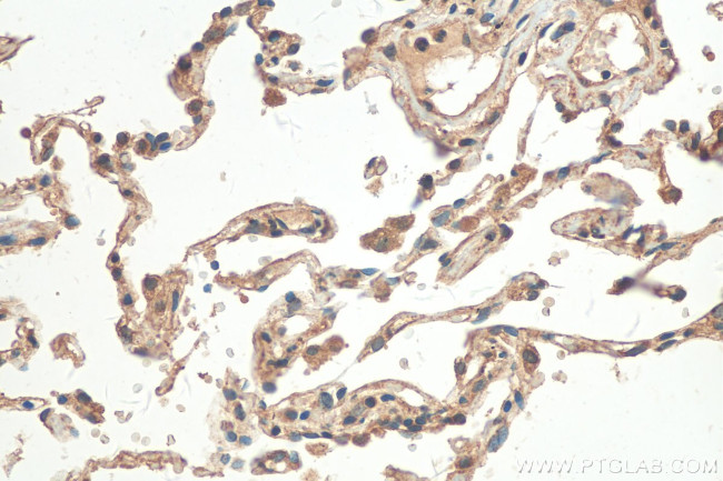 IL32 Antibody in Immunohistochemistry (Paraffin) (IHC (P))