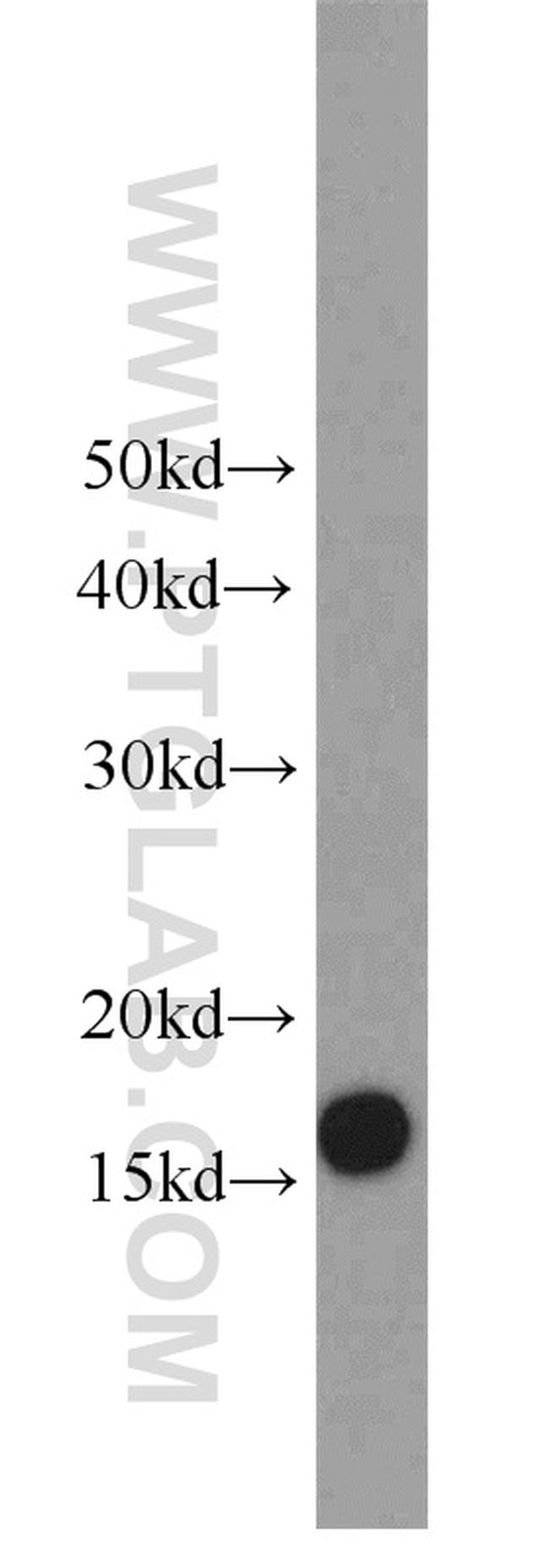 UBE2A Antibody in Western Blot (WB)