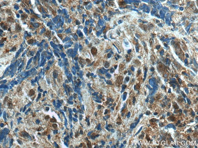 UBE2A Antibody in Immunohistochemistry (Paraffin) (IHC (P))