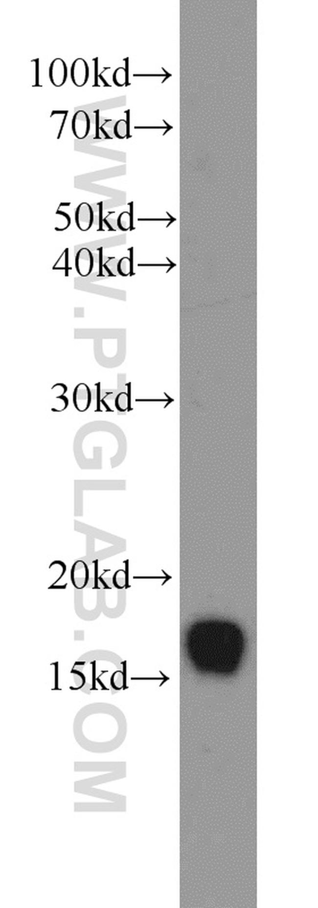 UBE2A Antibody in Western Blot (WB)