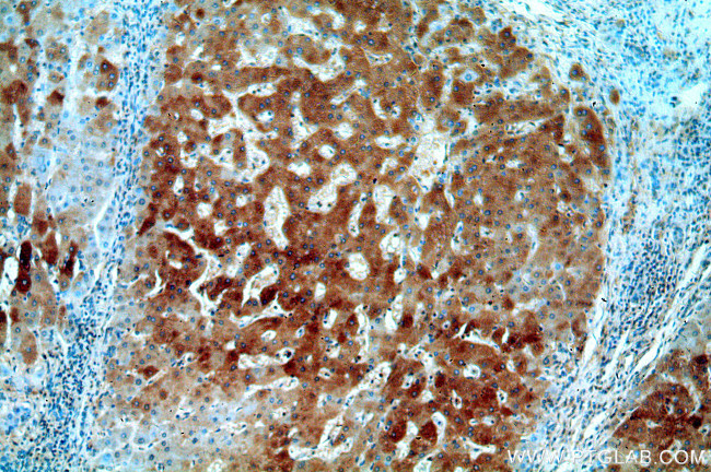 UCP2 Antibody in Immunohistochemistry (Paraffin) (IHC (P))