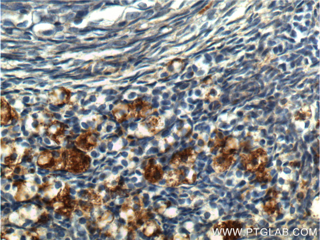 UCP2 Antibody in Immunohistochemistry (Paraffin) (IHC (P))