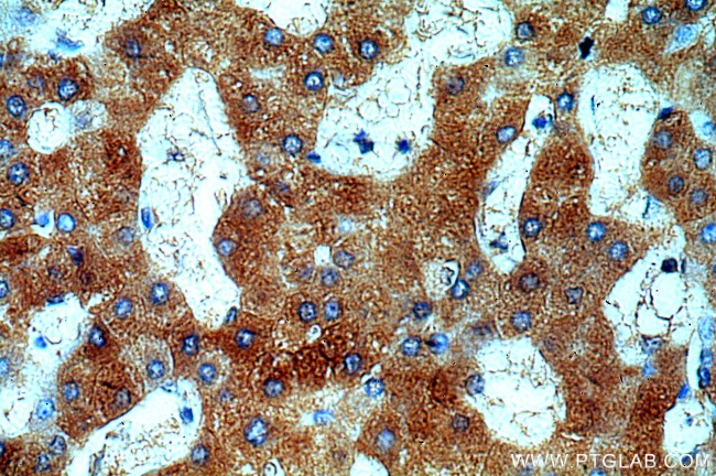 UCP2 Antibody in Immunohistochemistry (Paraffin) (IHC (P))