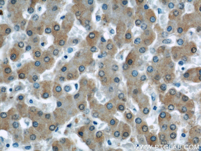 UCP2 Antibody in Immunohistochemistry (Paraffin) (IHC (P))