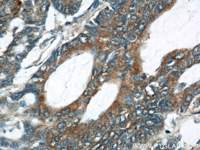 UCP2 Antibody in Immunohistochemistry (Paraffin) (IHC (P))