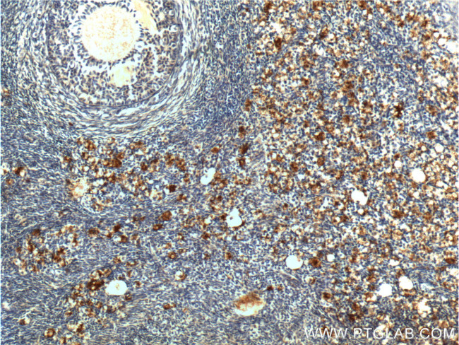 UCP2 Antibody in Immunohistochemistry (Paraffin) (IHC (P))