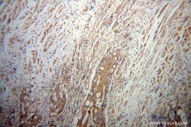 UCP2 Antibody in Immunohistochemistry (Paraffin) (IHC (P))