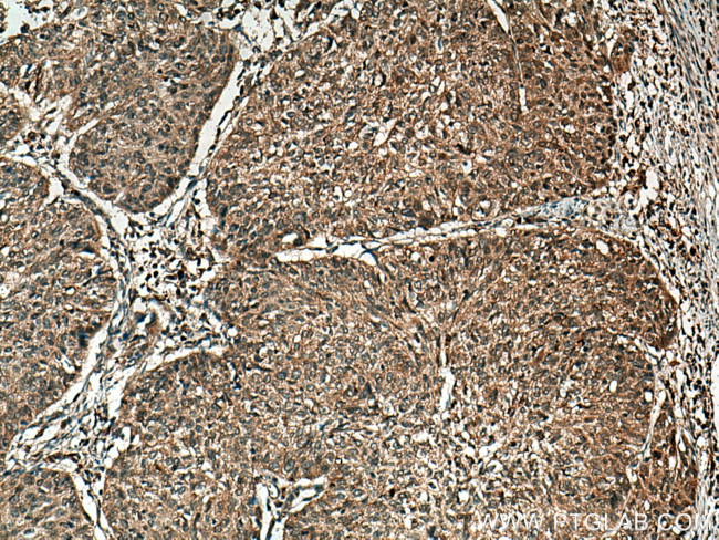 UCP2 Antibody in Immunohistochemistry (Paraffin) (IHC (P))