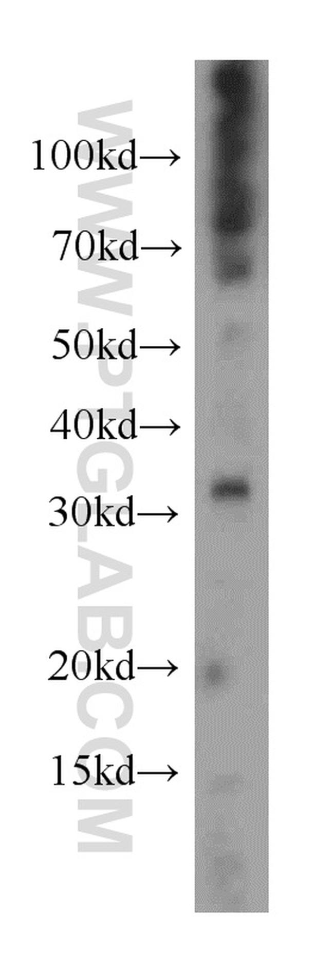 UCP2 Antibody in Western Blot (WB)